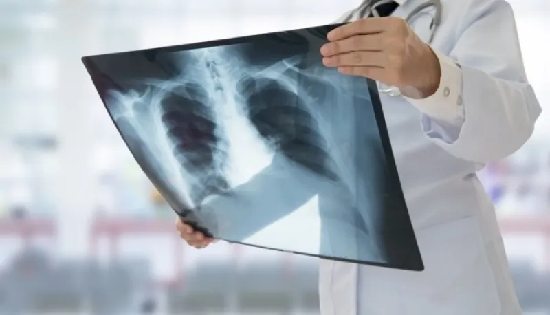 Про поширення туберкульозу, ВІЛ та наркозалежності на Полтавщині