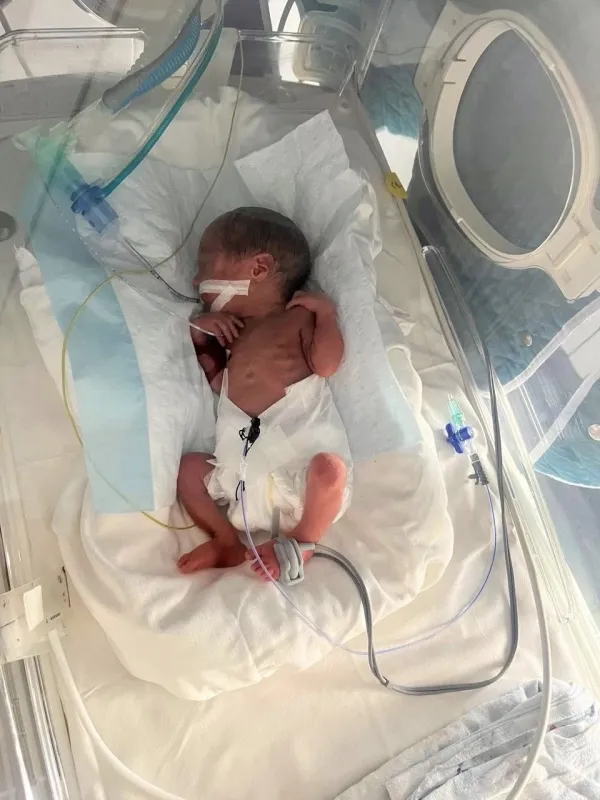 Маленьке диво: хлопчик, що народився у 900 грамів, після 79 днів лікування поїхав додому
