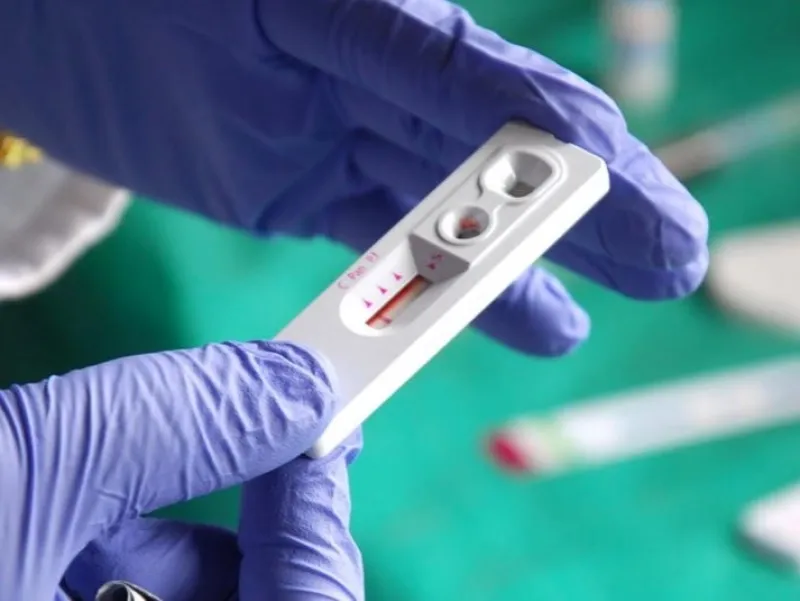 Лубенці можуть бешкоштовно пройти тестування на ВІЛ