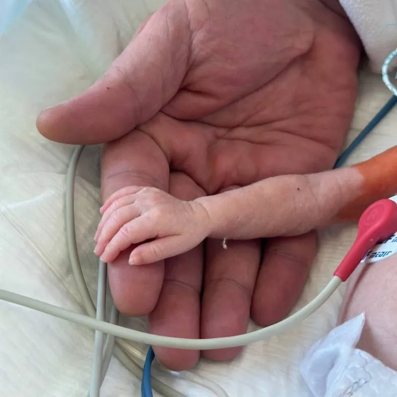 Серце розміром з горішок: медики врятували немовля з Полтавщини вагою 1100 грамів