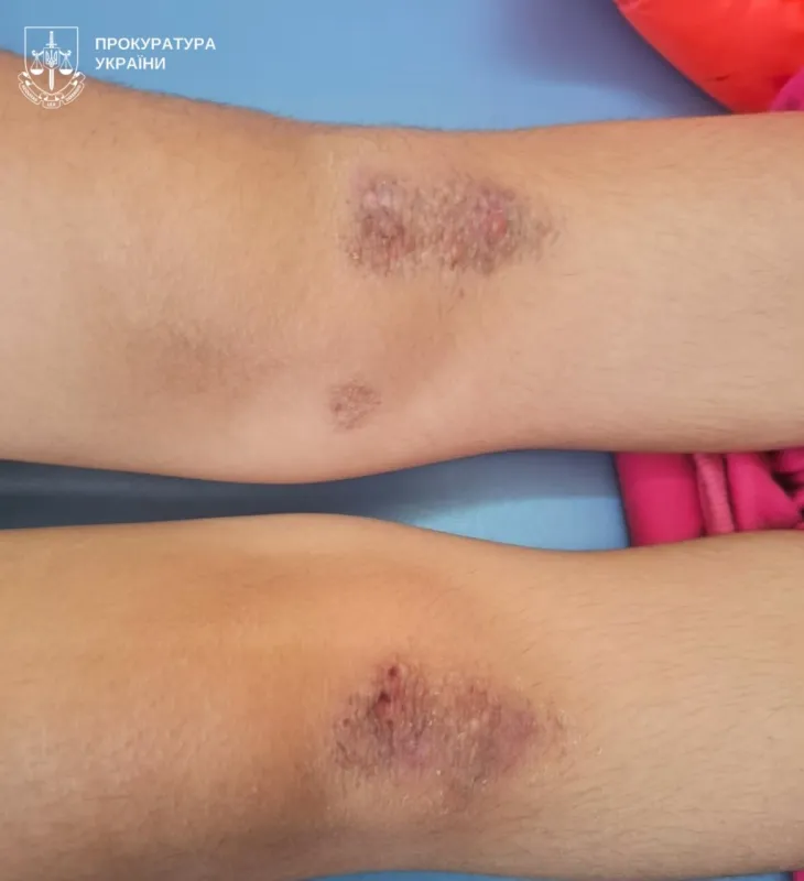 Дві доби стояли на колінах без їжі: на Полтавщині опікунку підозрюють у катуванні сестер