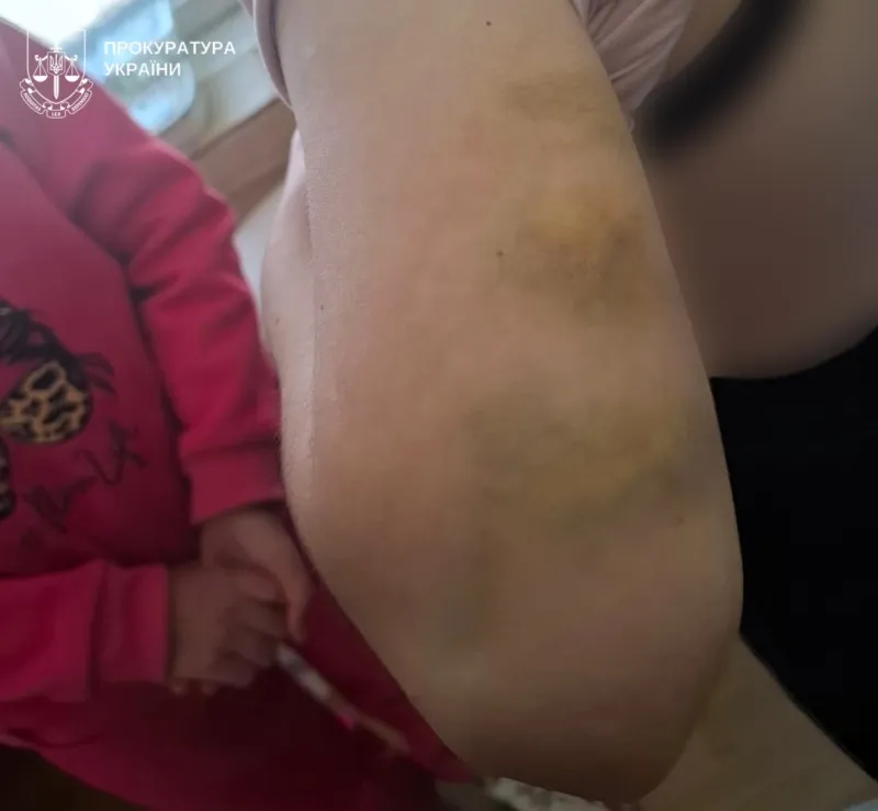 Дві доби стояли на колінах без їжі: на Полтавщині опікунку підозрюють у катуванні сестер