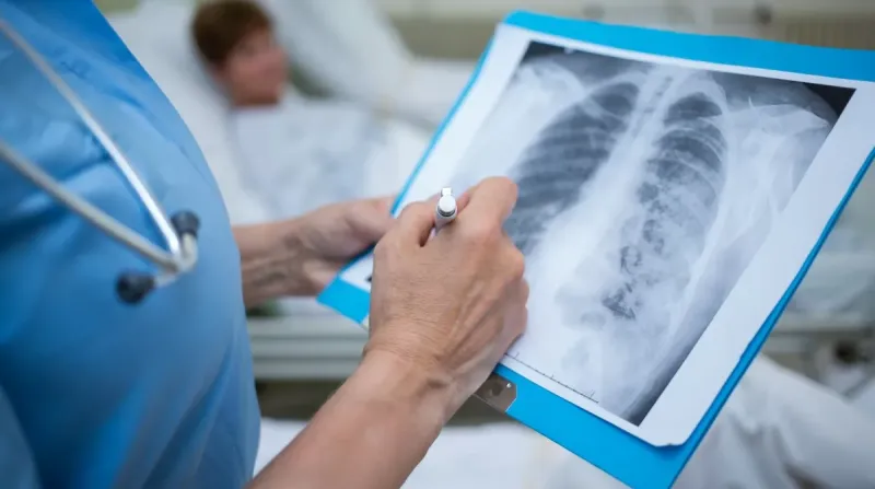 На Лубенщині знизилась захворюваність на туберкульоз: як виявити хворобу